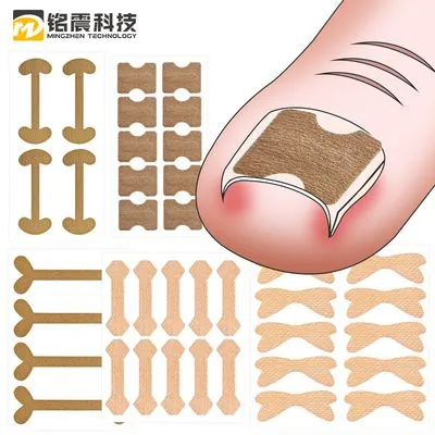 Glue-Free Nail Correction Patch (Ingrown Toenail)